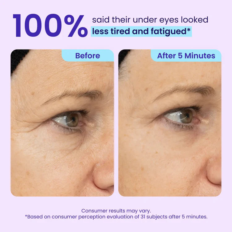 Instant Lift Eye Gel — Reduce the Look of Eye Bags in Minutes 🔥