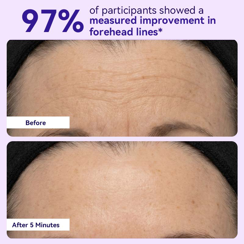 Instant Lift Eye Gel — Reduce the Look of Eye Bags in Minutes 🔥